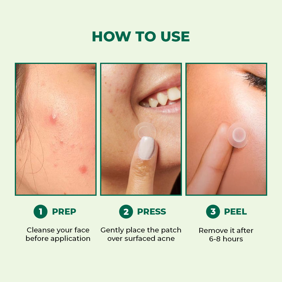 Conscious Chemist Self Dissolving Microneedle Acne Patches | Kills Bacteria & Reduces Redness