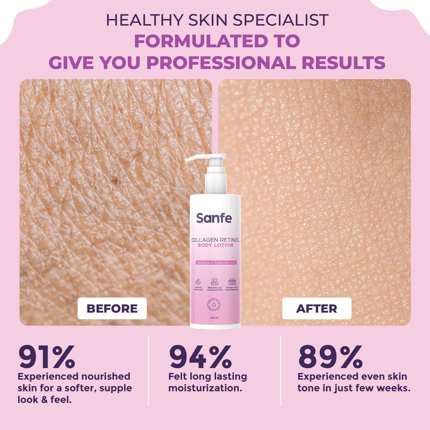 Sanfe Collagen Retinol Body Lotion For Skin Tightening, Firming, Stretch Marks, Wrinkles & Anti Aging Brighter, Soft Skin For Men & Women - 200ml