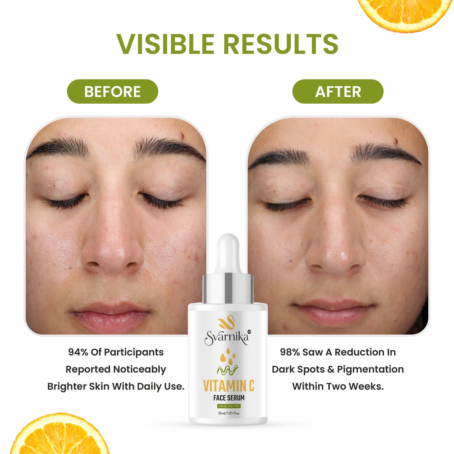 SVARNIKA Vitamin C Serum for Glow & Pigmentation (30 ml) Svarnika