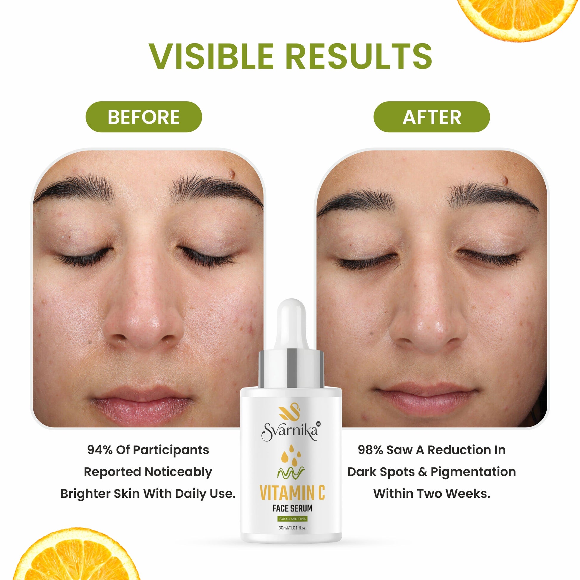 SVARNIKA Vitamin C Serum for Glow & Pigmentation (30 ml) Svarnika