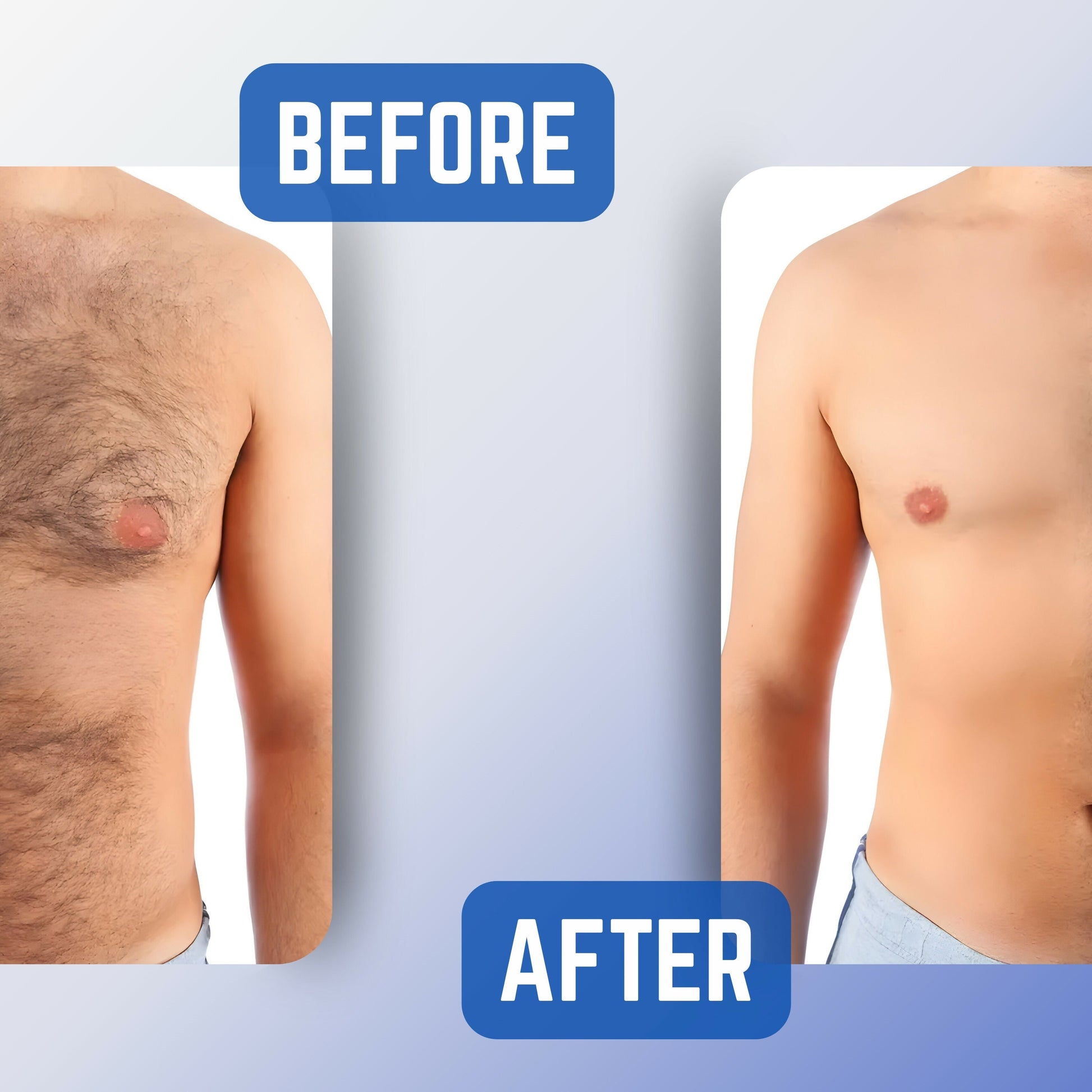 SVARNIKA Pain-Free Hair Removal Spray Cream (100 ml) Svarnika