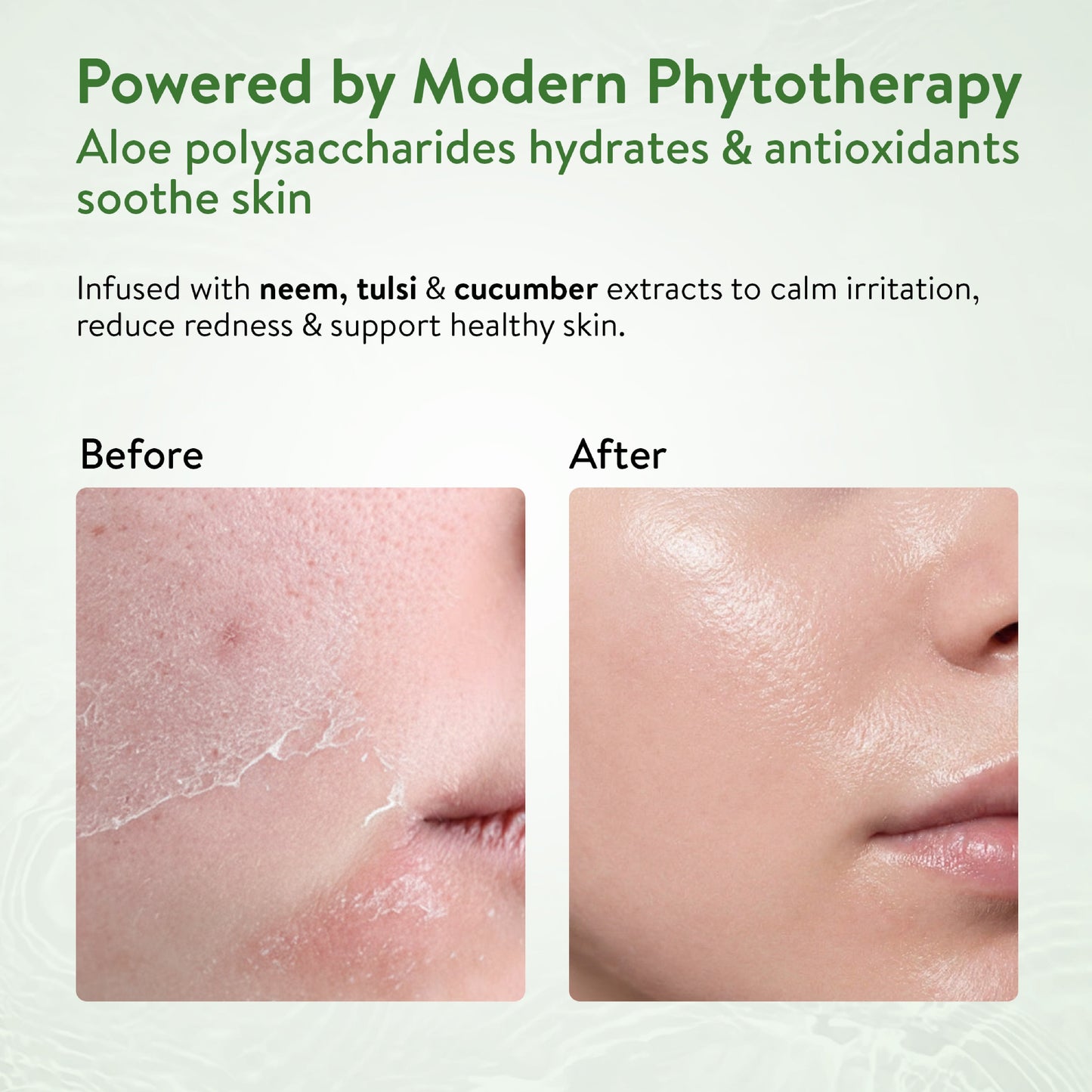 Ayouthveda Aloe Vera Gel Pack of 3 (150 gm) Aimil Ayouthveda