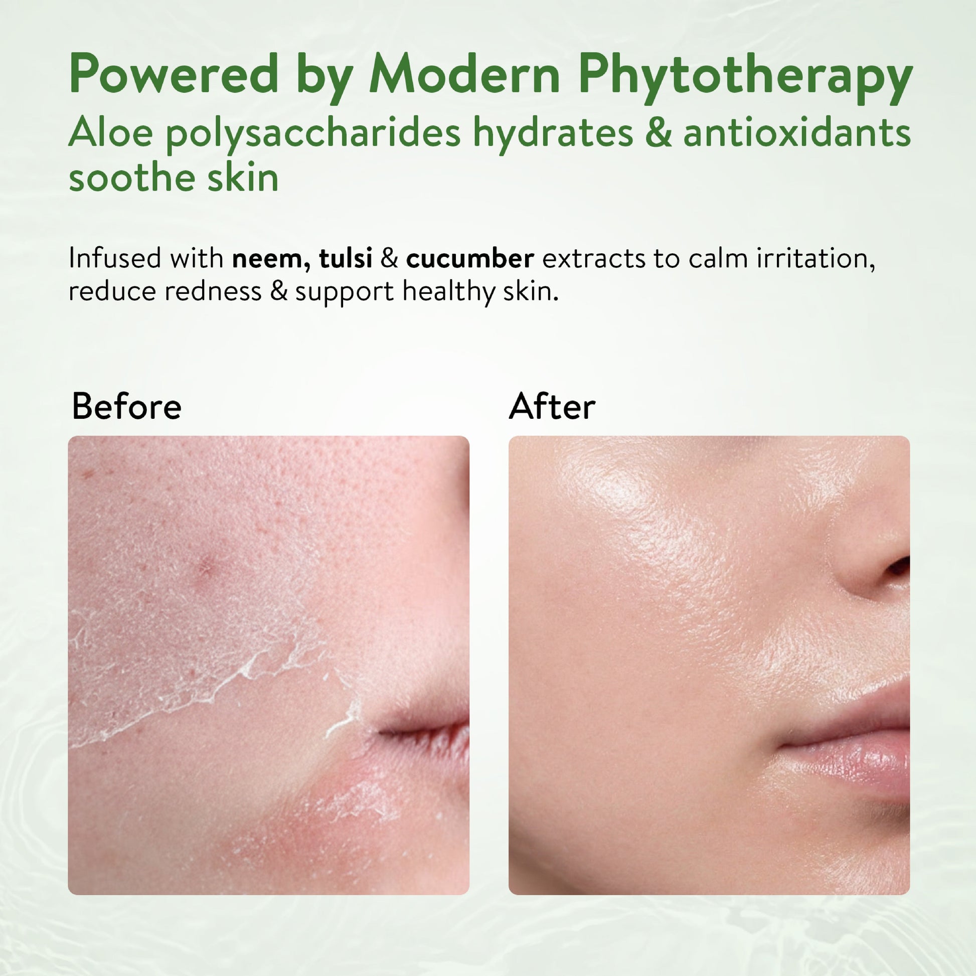 Ayouthveda Aloe Vera Gel Pack of 3 (150 gm) Aimil Ayouthveda