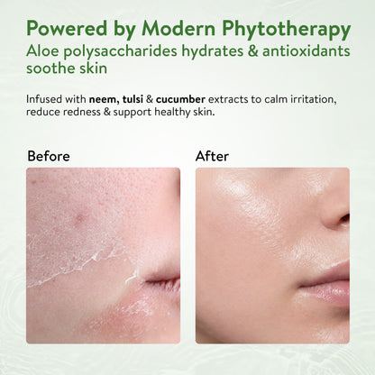 Ayouthveda Aloe Vera Gel Pack of 3 (150 gm) Aimil Ayouthveda