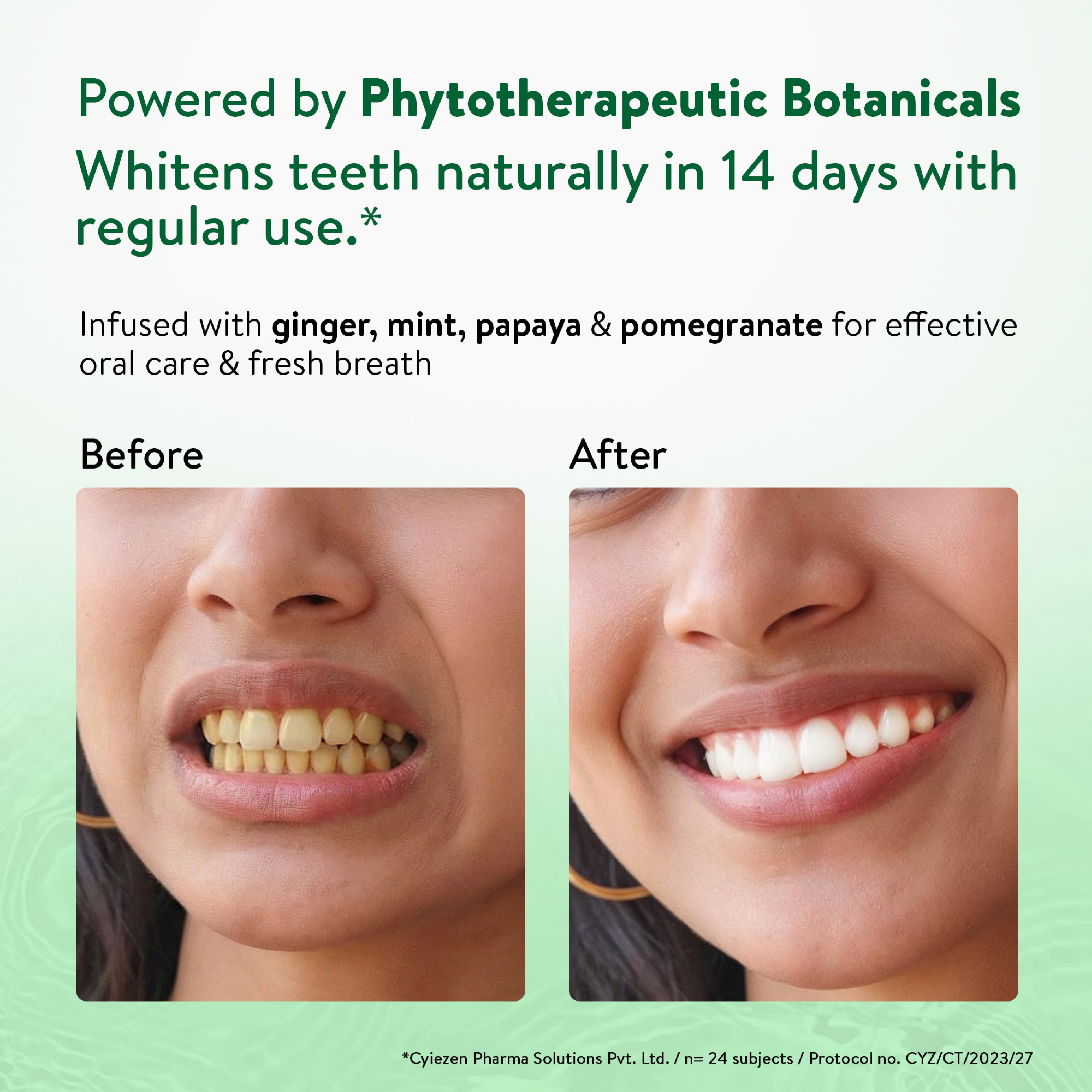 Ayurvedic Natural Whitening toothpaste Pack of 3 (100 gm) Aimil Ayouthveda