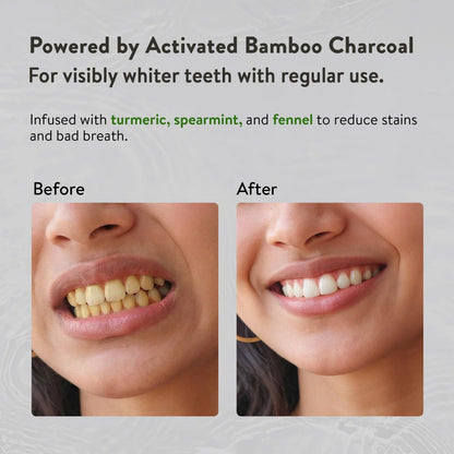 Ayurvedic Charcoal White toothpaste Pack of 4 (100 gm) Aimil Ayouthveda