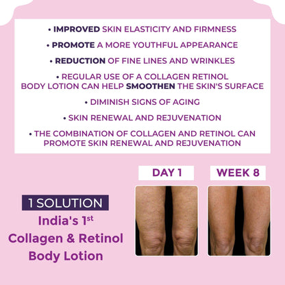 Sanfe Collagen Retinol Body Lotion For Skin Tightening, Firming, Stretch Marks, Wrinkles & Anti Aging Brighter, Soft Skin For Men & Women - 200ml