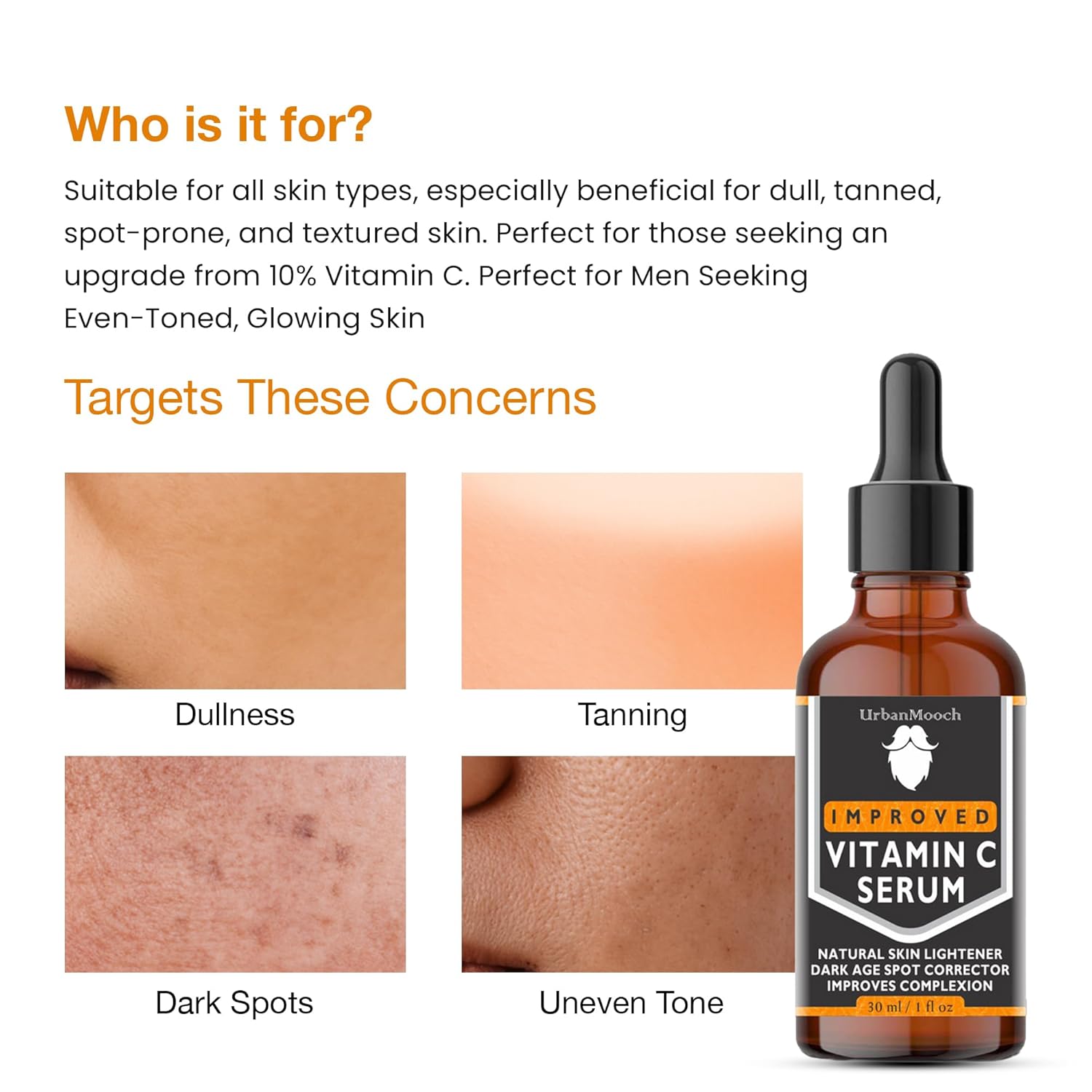 UrbanMooch 10% Vitamin C Face Serum | With Vitamin C, 5% Niacinamide & Hyaluronic Acid | Fades Dark Spots | Reduces Pigmentation | Boosts Collagen | Brightens Skin | Suitable For All Skin Types | 30ml Lohiya Retails