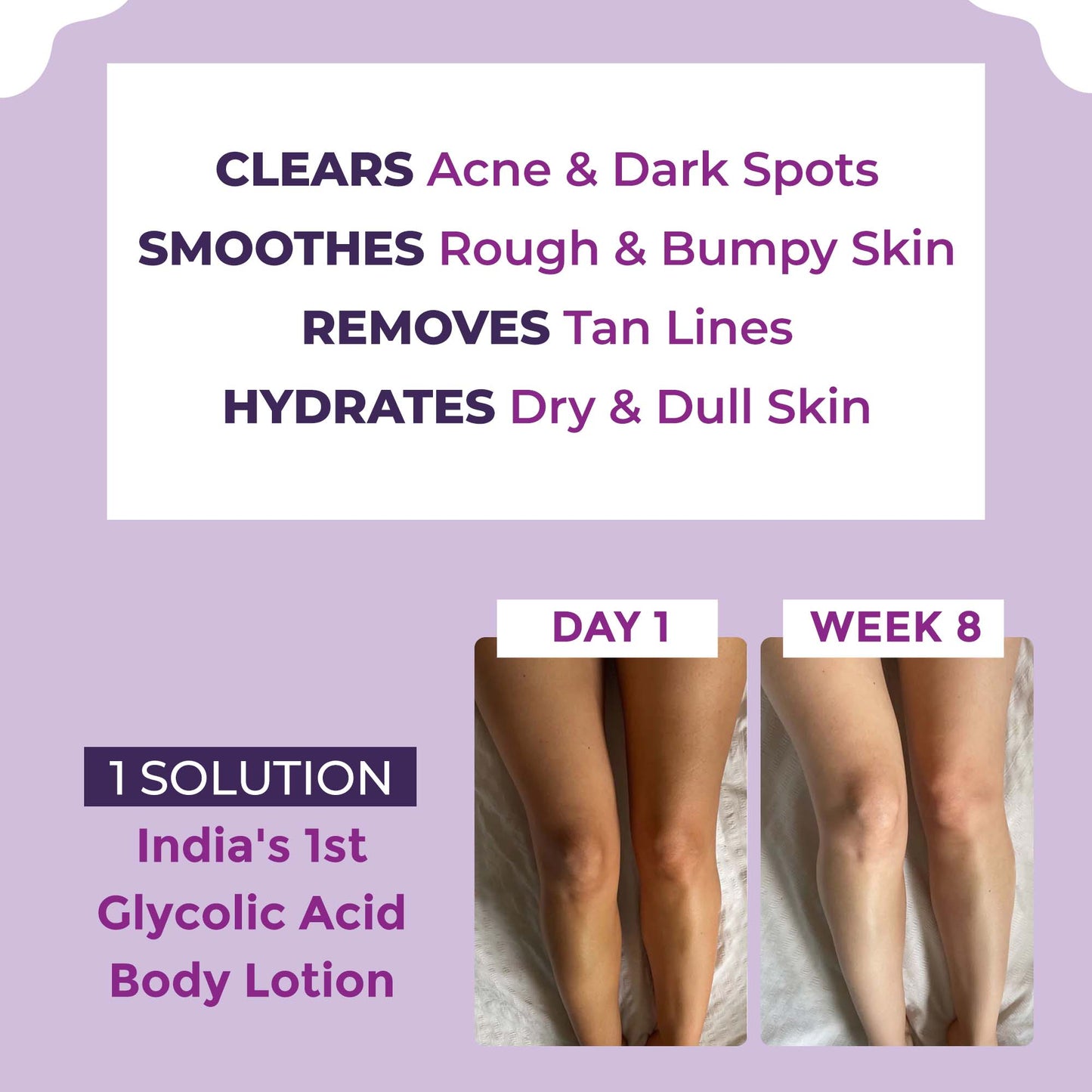 Sanfe Clear & Confident Glycolic Acid Body Lotion