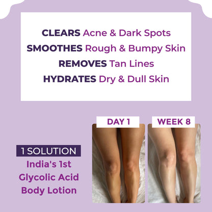 Sanfe Clear & Confident Glycolic Acid Body Lotion