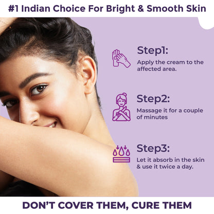 Sanfe Spotlite Body Cream For Dark Neck, Joints and Skinfolds Enriched with 3% Lactic Acid, Retinol & SPF 15 For Dark Patches, Detanning, Anti Aging and Skin Tightening Helps in Exfoliation, Lightening & 24 Hr Long Moisture - 60gm | For Indian Skin