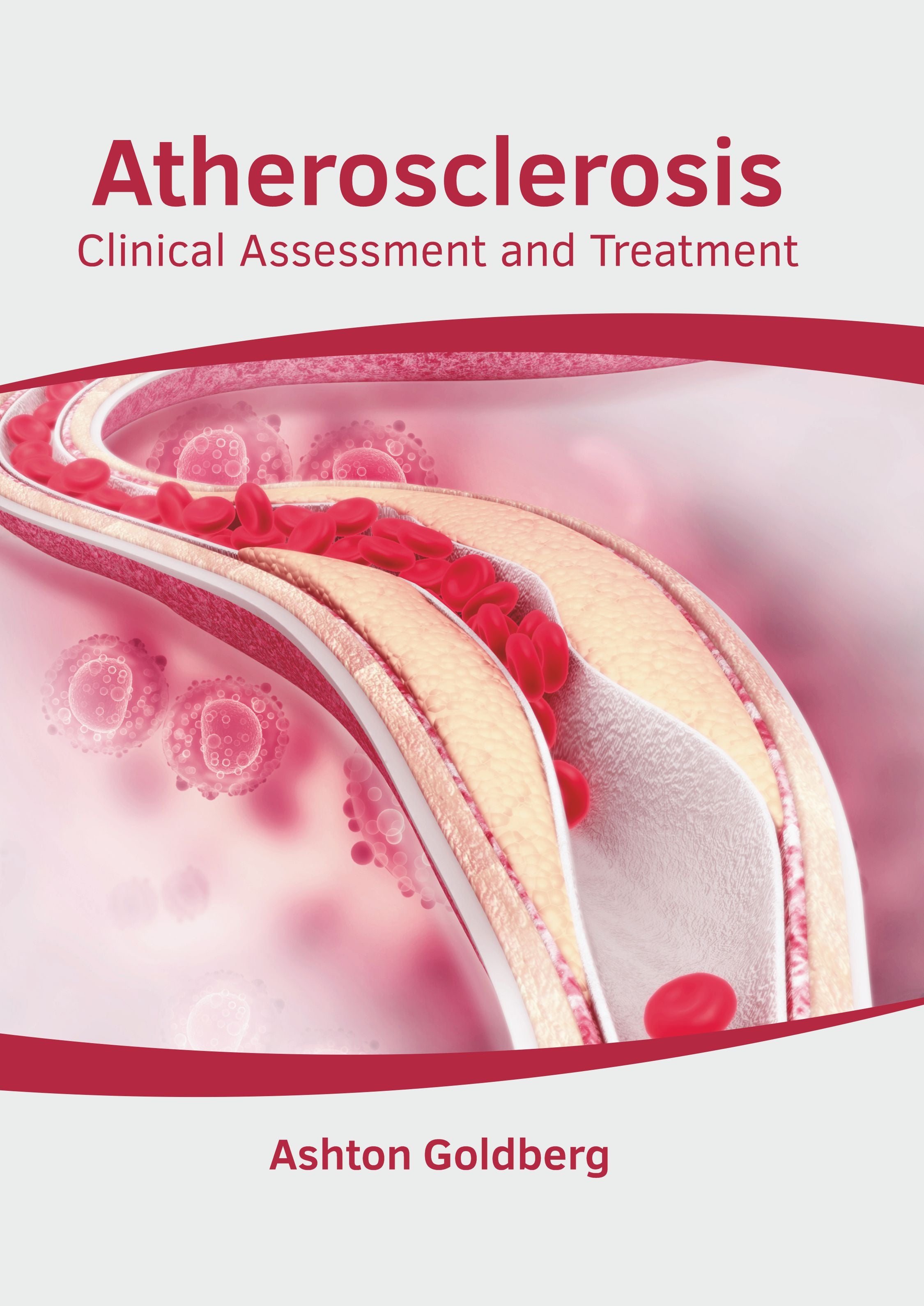 Atherosclerosis: Clinical Assessment and Treatment - Prints Publications