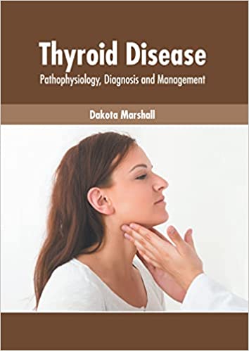 Thyroid Disease: Pathophysiology, Diagnosis and Management - Prints Publications