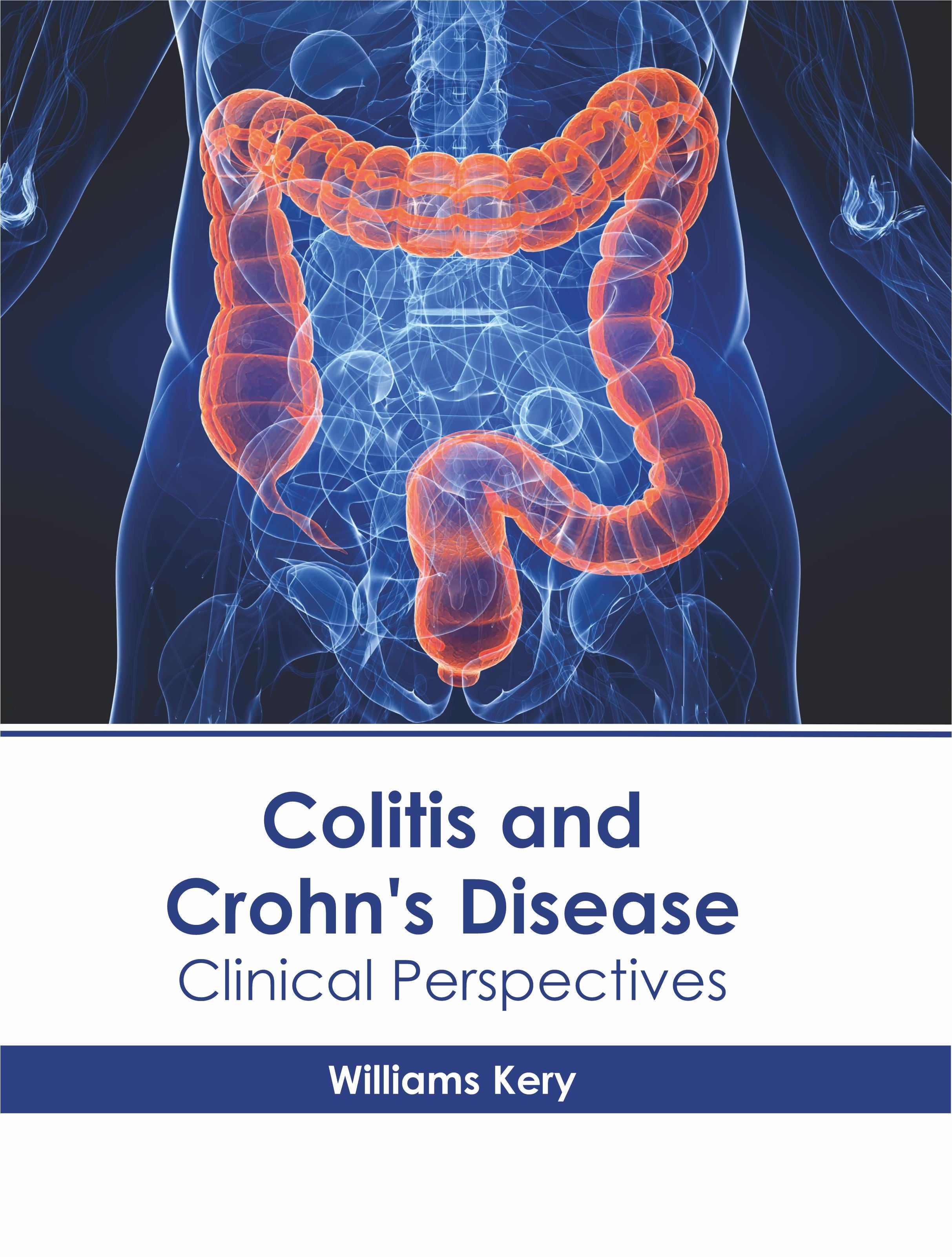 Colitis and Crohn's Disease: Clinical Perspectives - Prints Publications