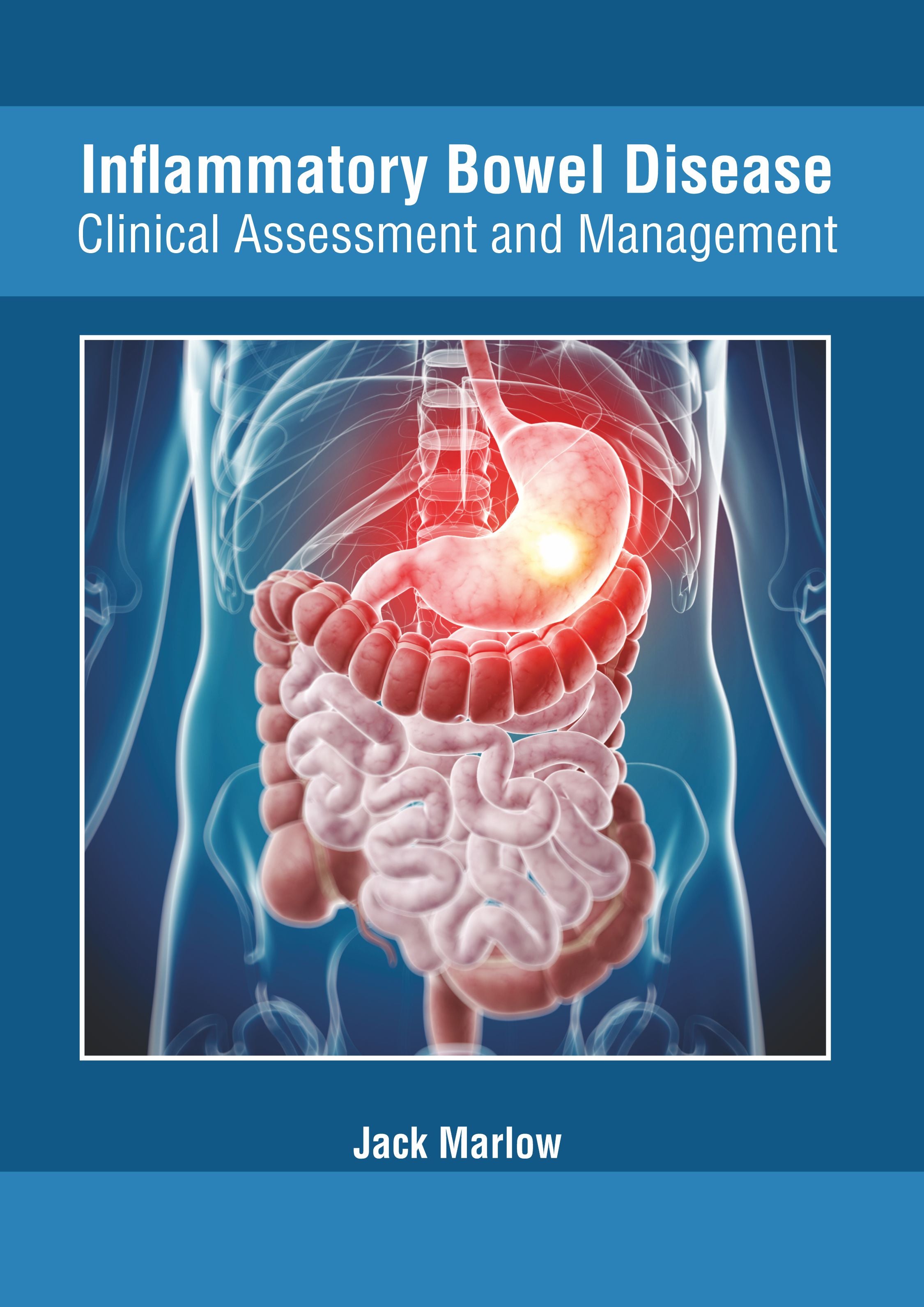 Inflammatory Bowel Disease: Clinical Assessment and Management - Prints Publications