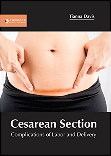 Cesarean Section: Complications of Labor and Delivery - Prints Publications