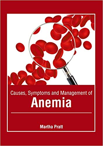 Causes, Symptoms and Management of Anemia - Prints Publications