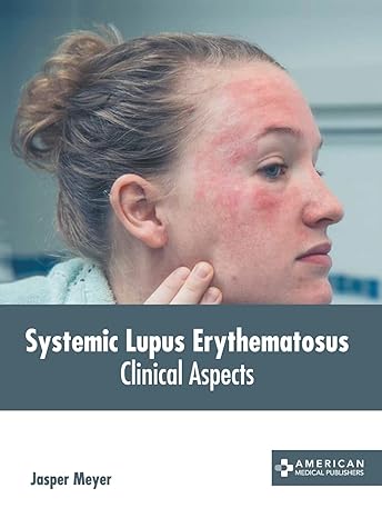 Systemic Lupus Erythematosus: Clinical Aspects - Prints Publications
