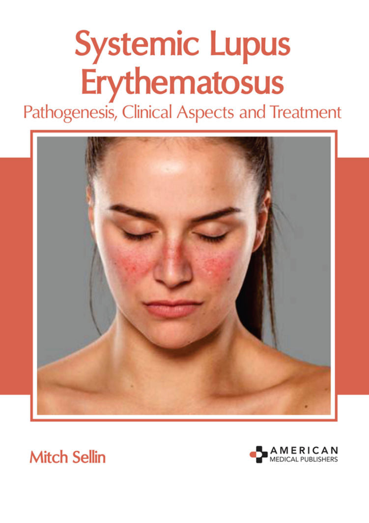 Systemic Lupus Erythematosus: Pathogenesis, Clinical Aspects and Treatment - Prints Publications