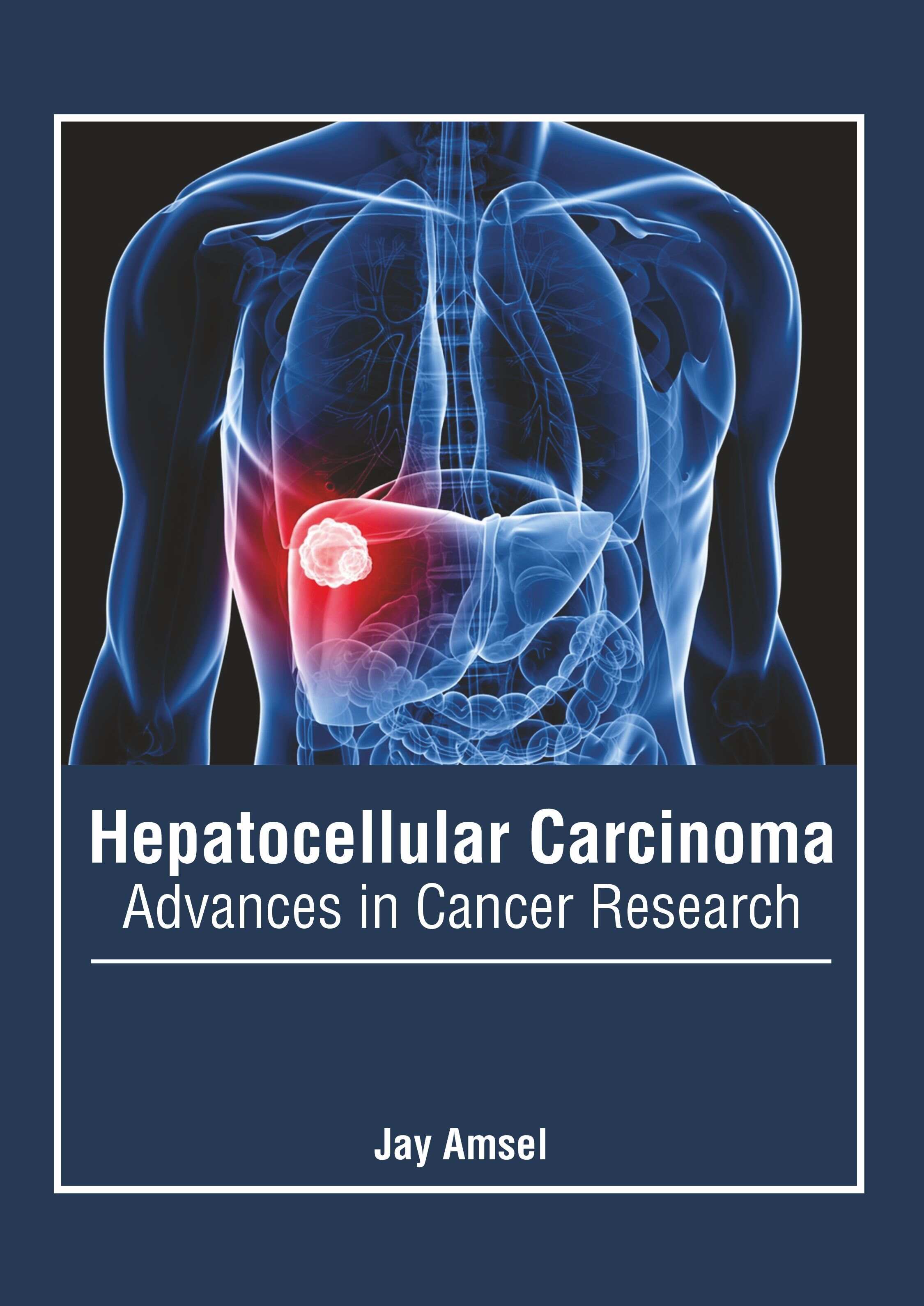 Hepatocellular Carcinoma: Advances in Cancer Research - Prints Publications