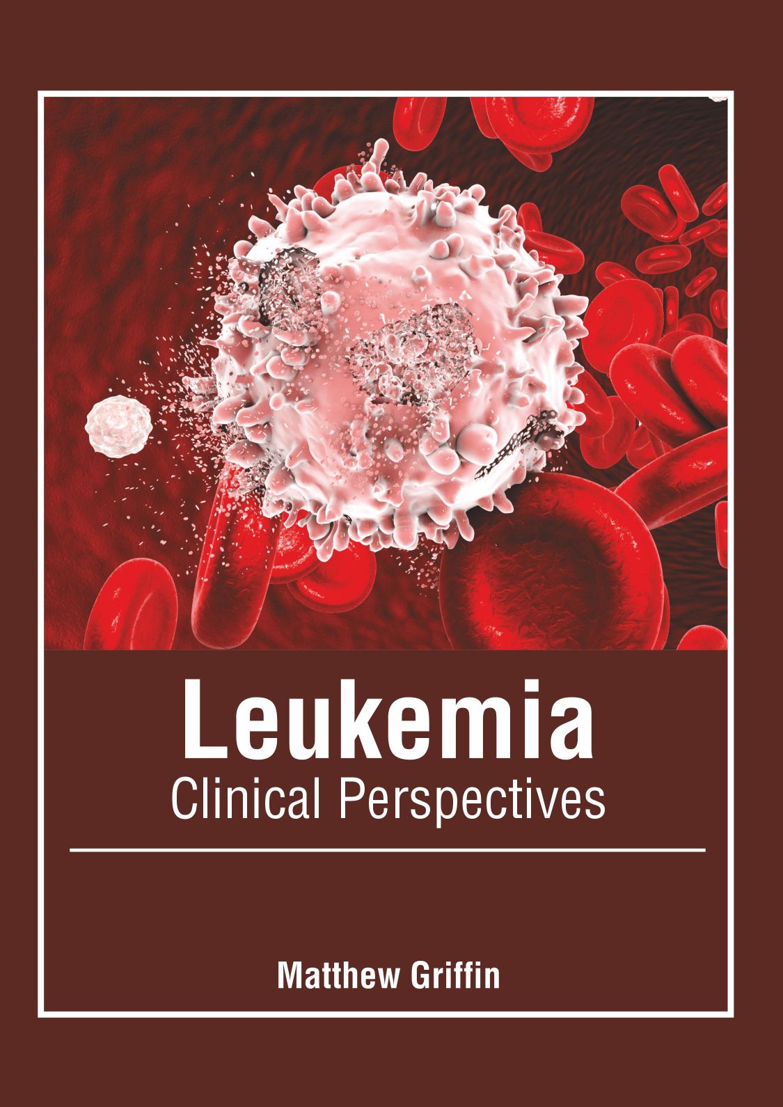 Leukemia: Clinical Perspectives - Prints Publications