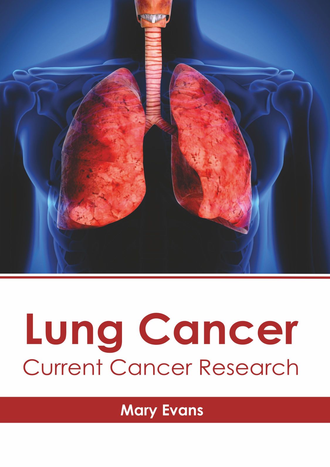 Lung Cancer: Current Cancer Research - Prints Publications