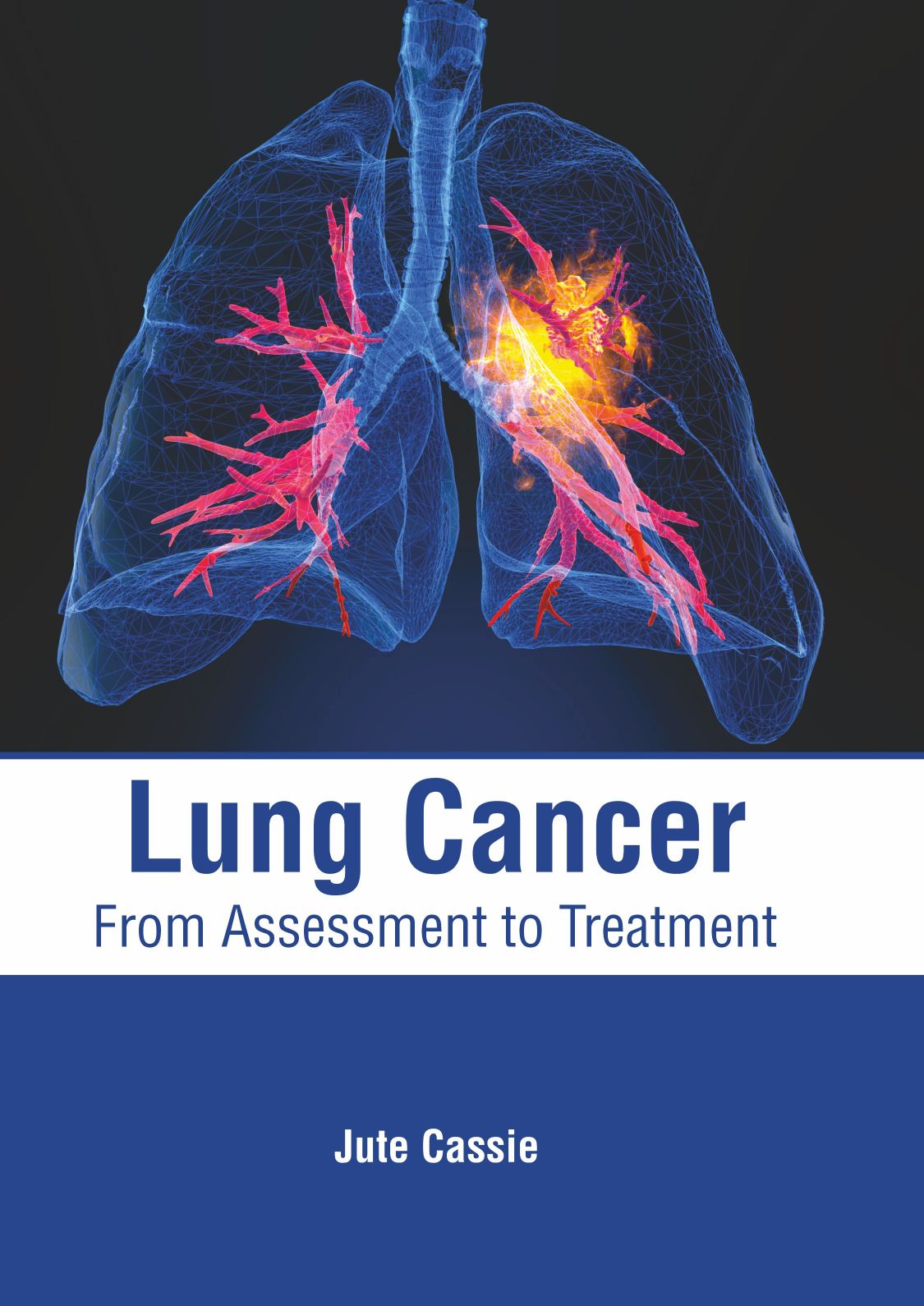 Lung Cancer: From Assessment to Treatment - Prints Publications