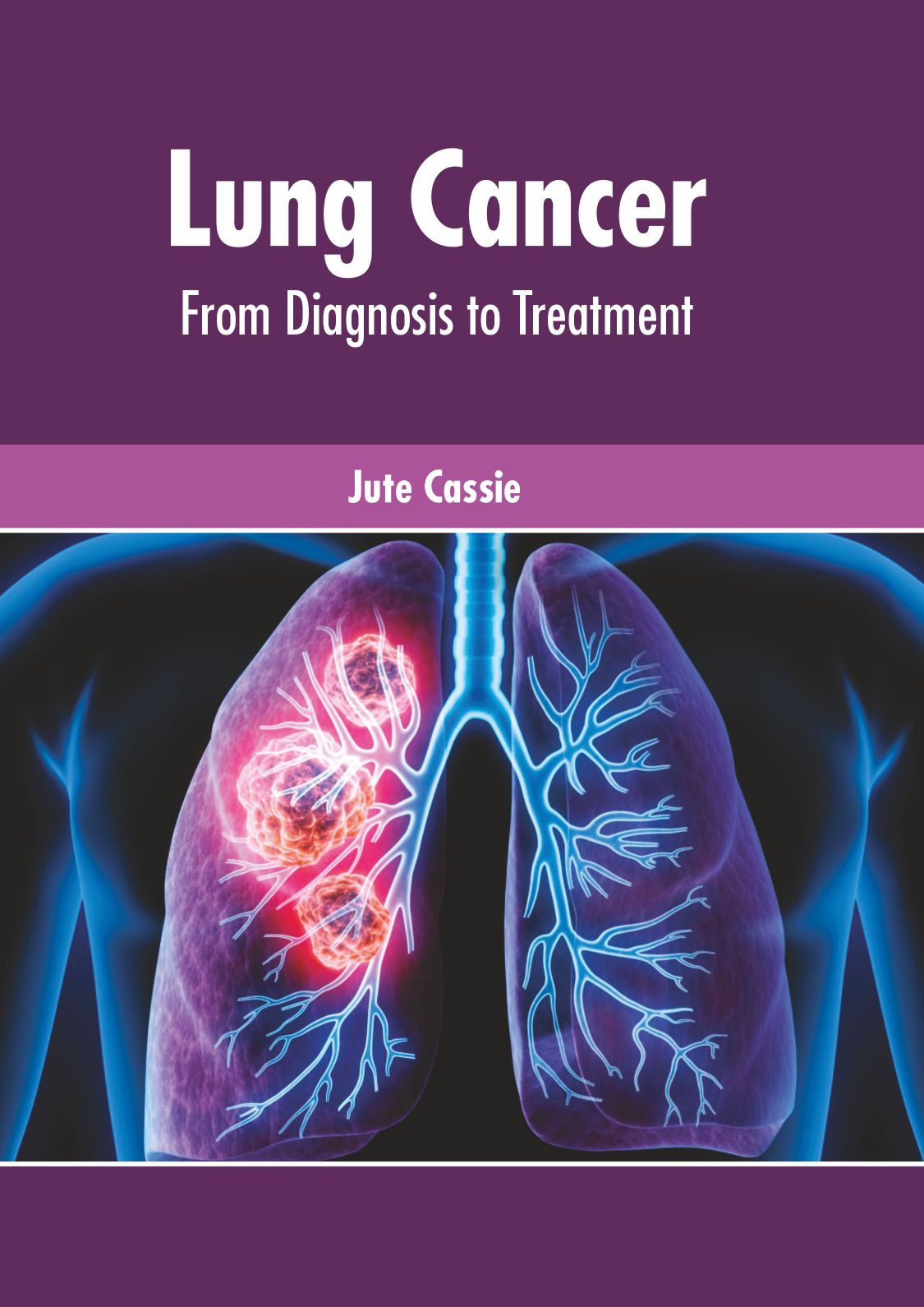 Lung Cancer: From Diagnosis to Treatment - Prints Publications
