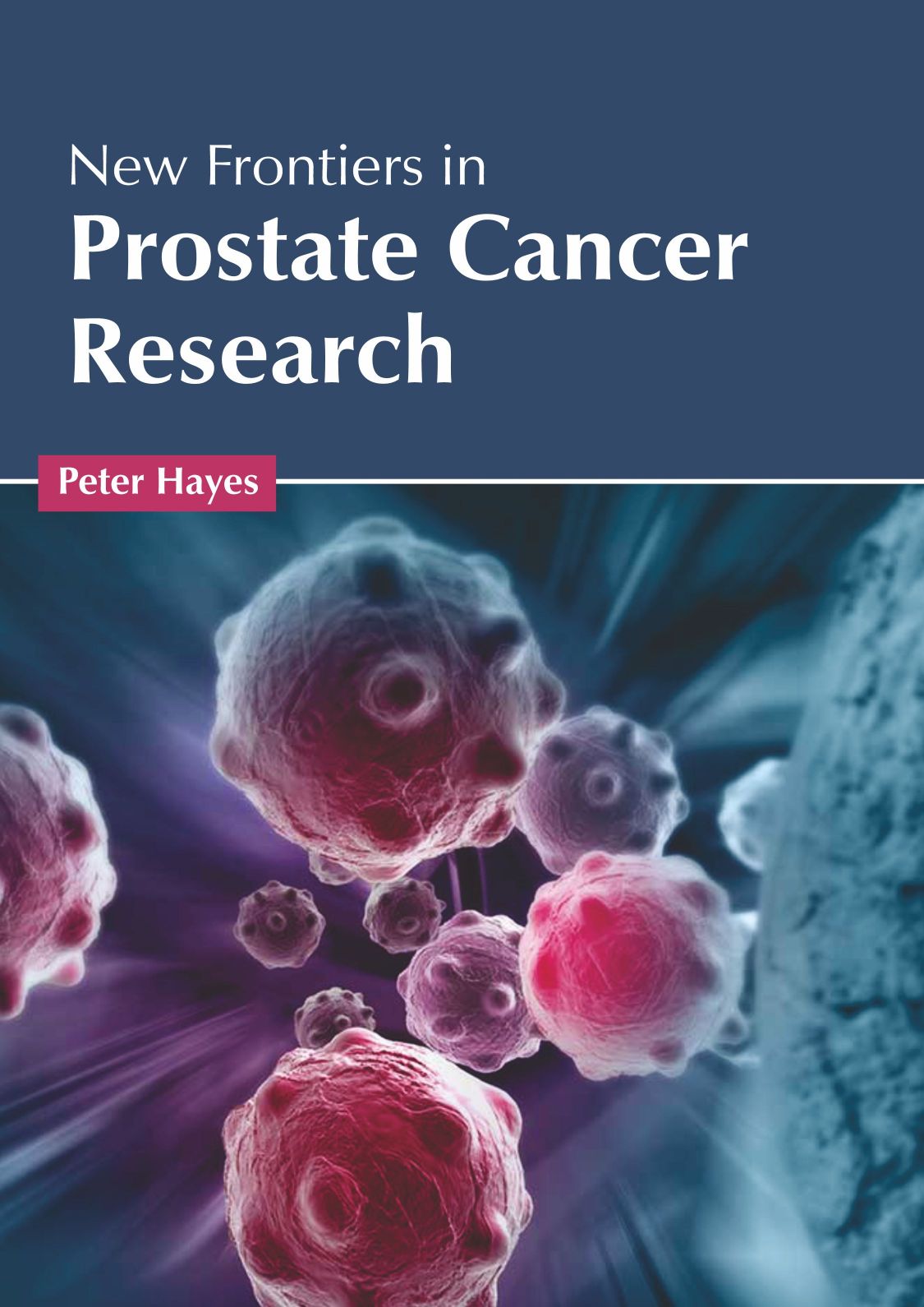 New Frontiers in Prostate Cancer Research - Prints Publications