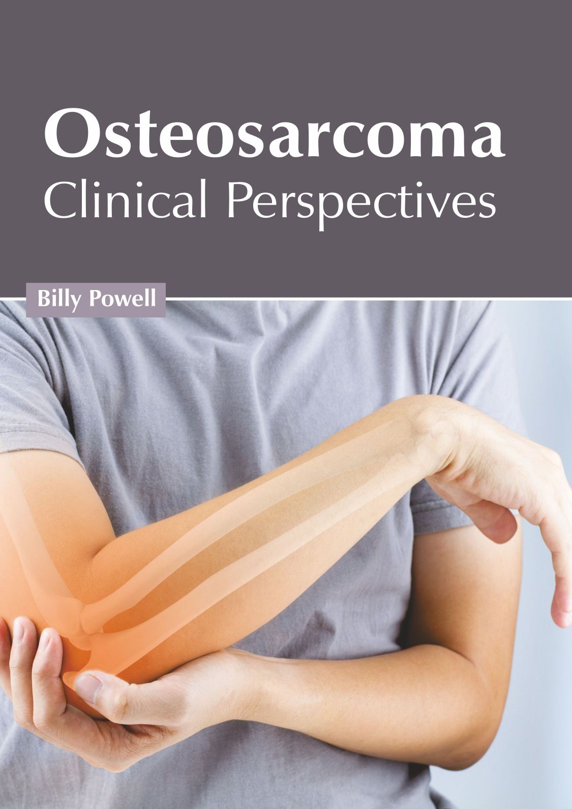 Osteosarcoma: Clinical Perspectives - Prints Publications