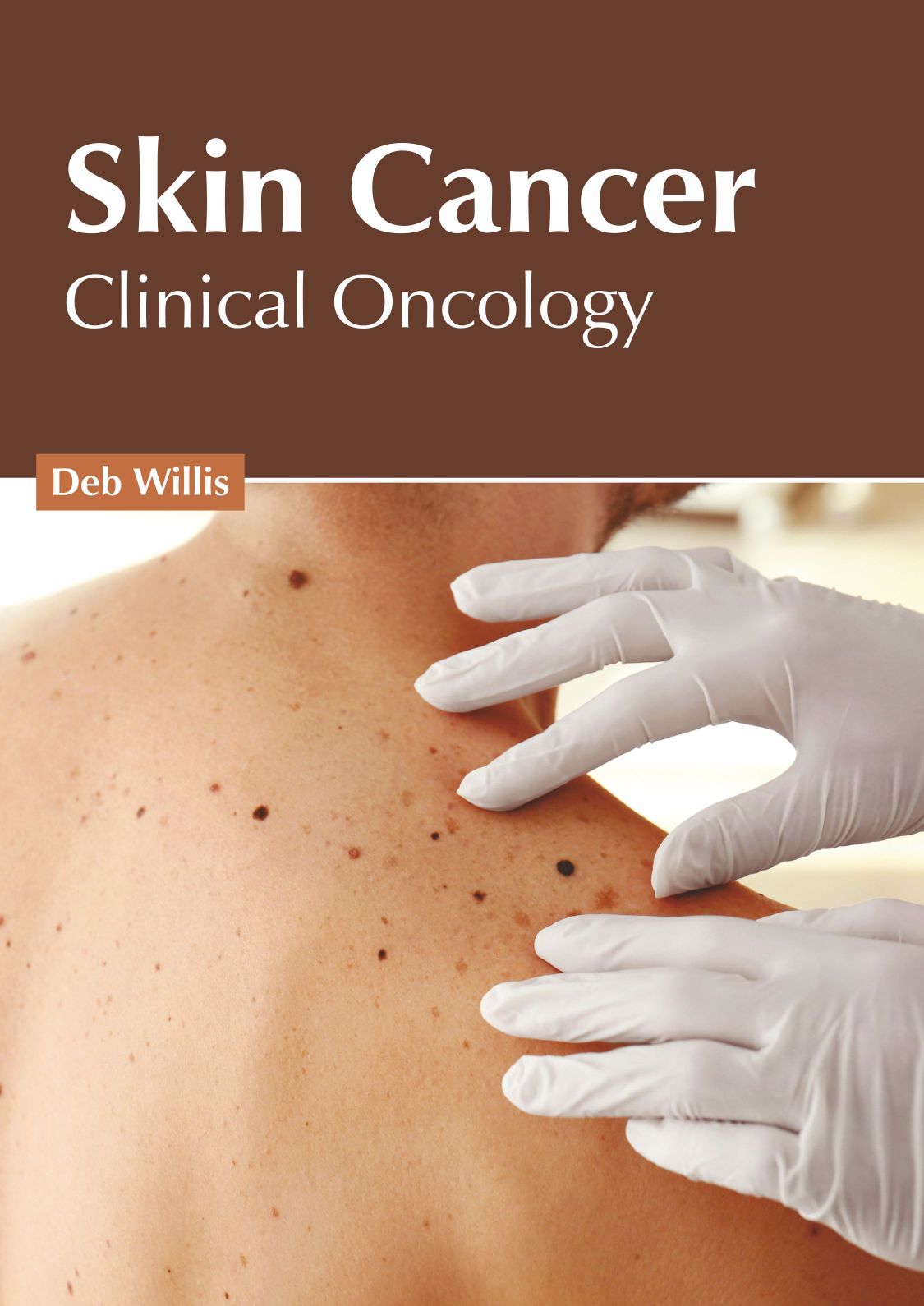 Skin Cancer: Clinical Oncology - Prints Publications