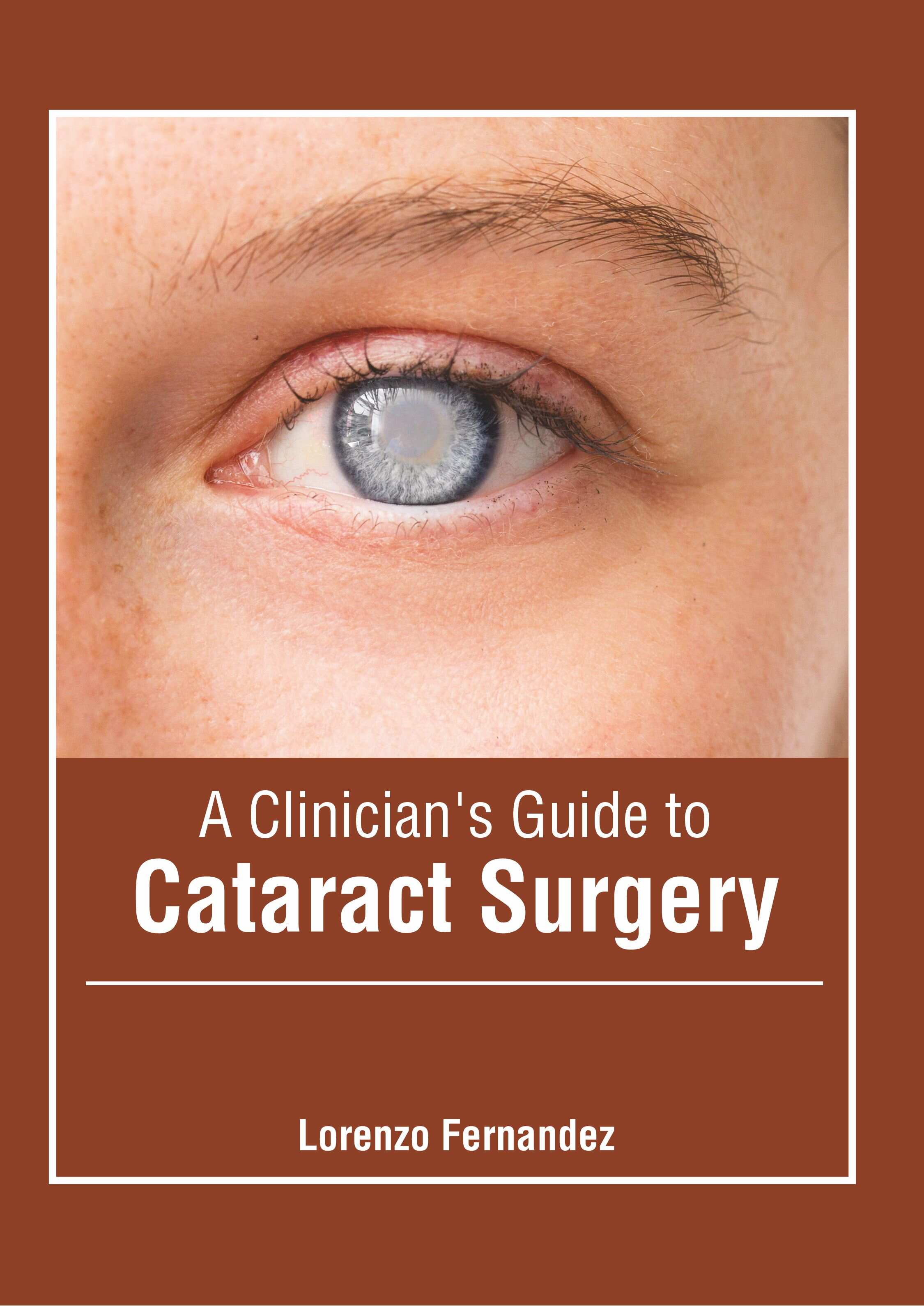 A Clinician's Guide to Cataract Surgery - Prints Publications