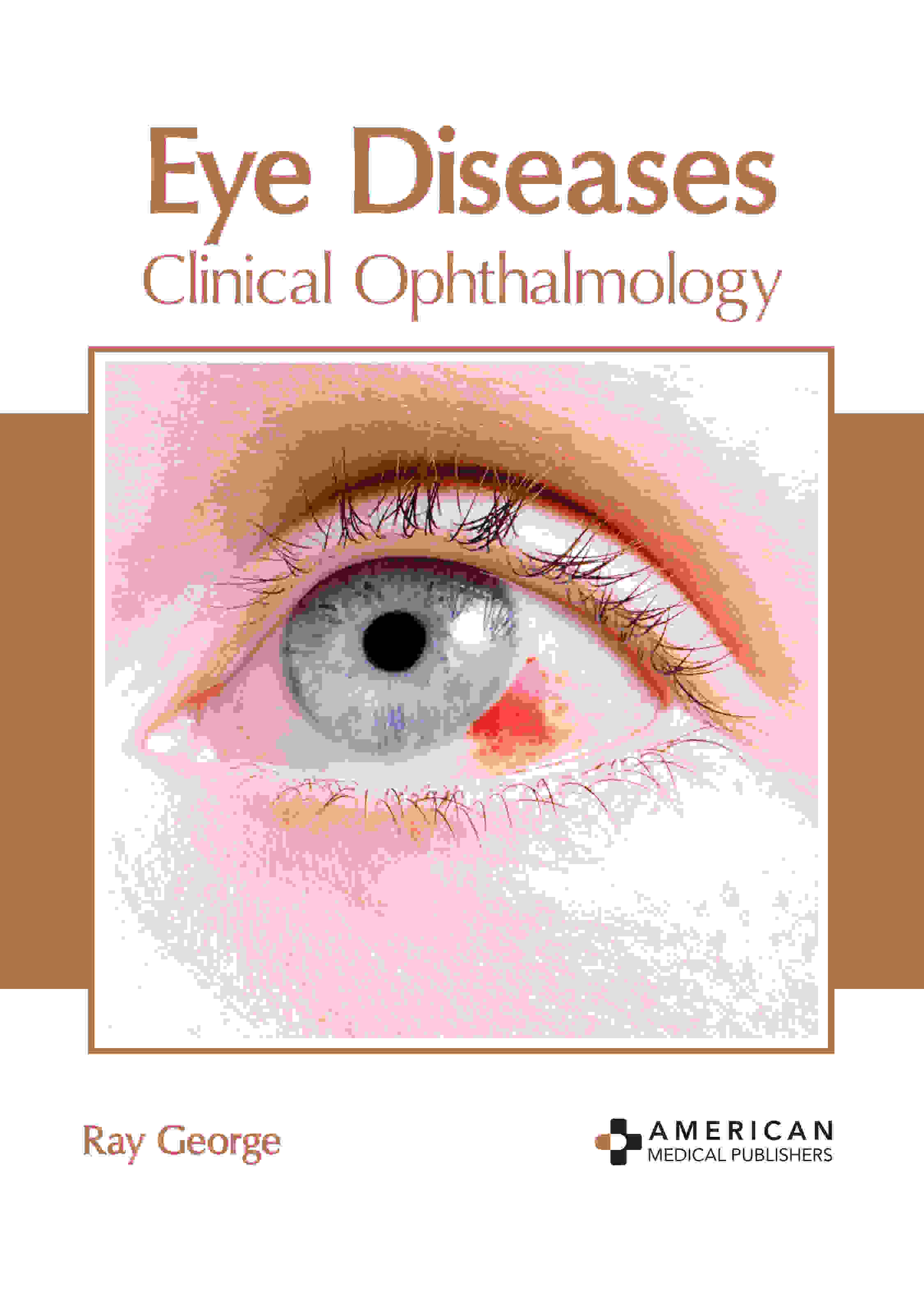 Eye Diseases: Clinical Ophthalmology - Prints Publications