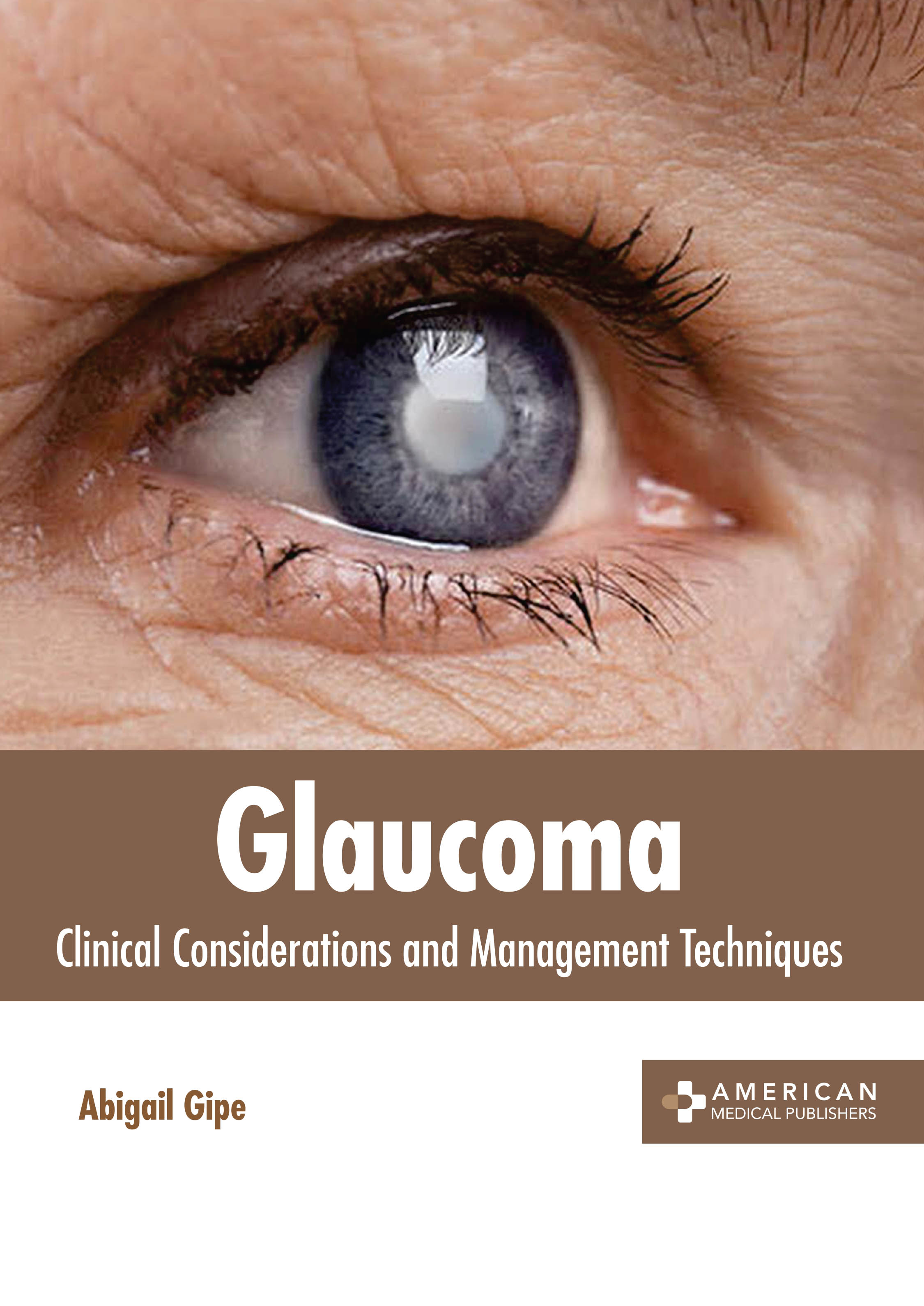 Glaucoma: Clinical Considerations and Management Techniques - Prints Publications