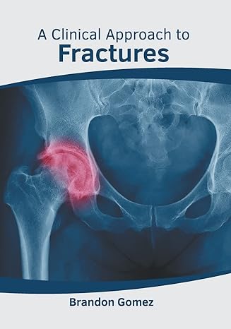 A Clinical Approach to Fractures - Prints Publications