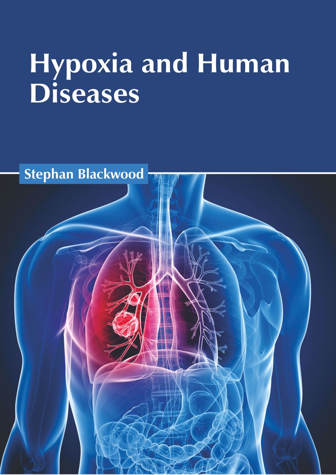 Hypoxia and Human Diseases - Prints Publications