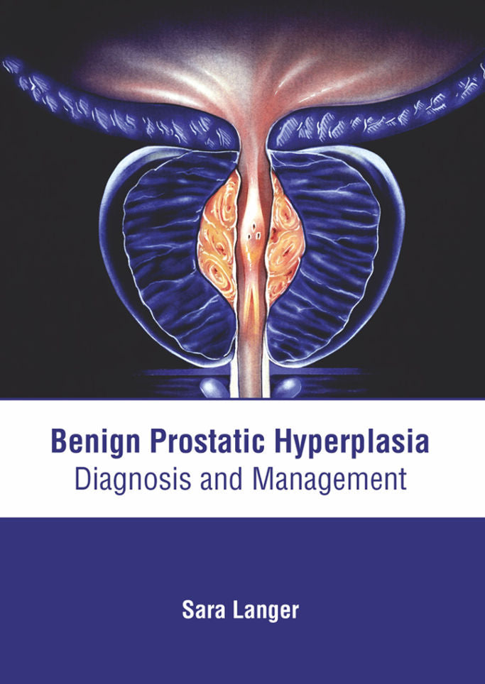 Benign Prostatic Hyperplasia: Diagnosis and Management - Prints Publications