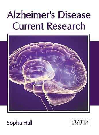 Alzheimer's Disease: Current Research - Prints Publications