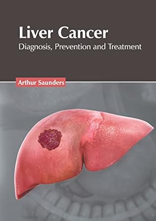 Liver Cancer: Diagnosis, Prevention and Treatment - Prints Publications