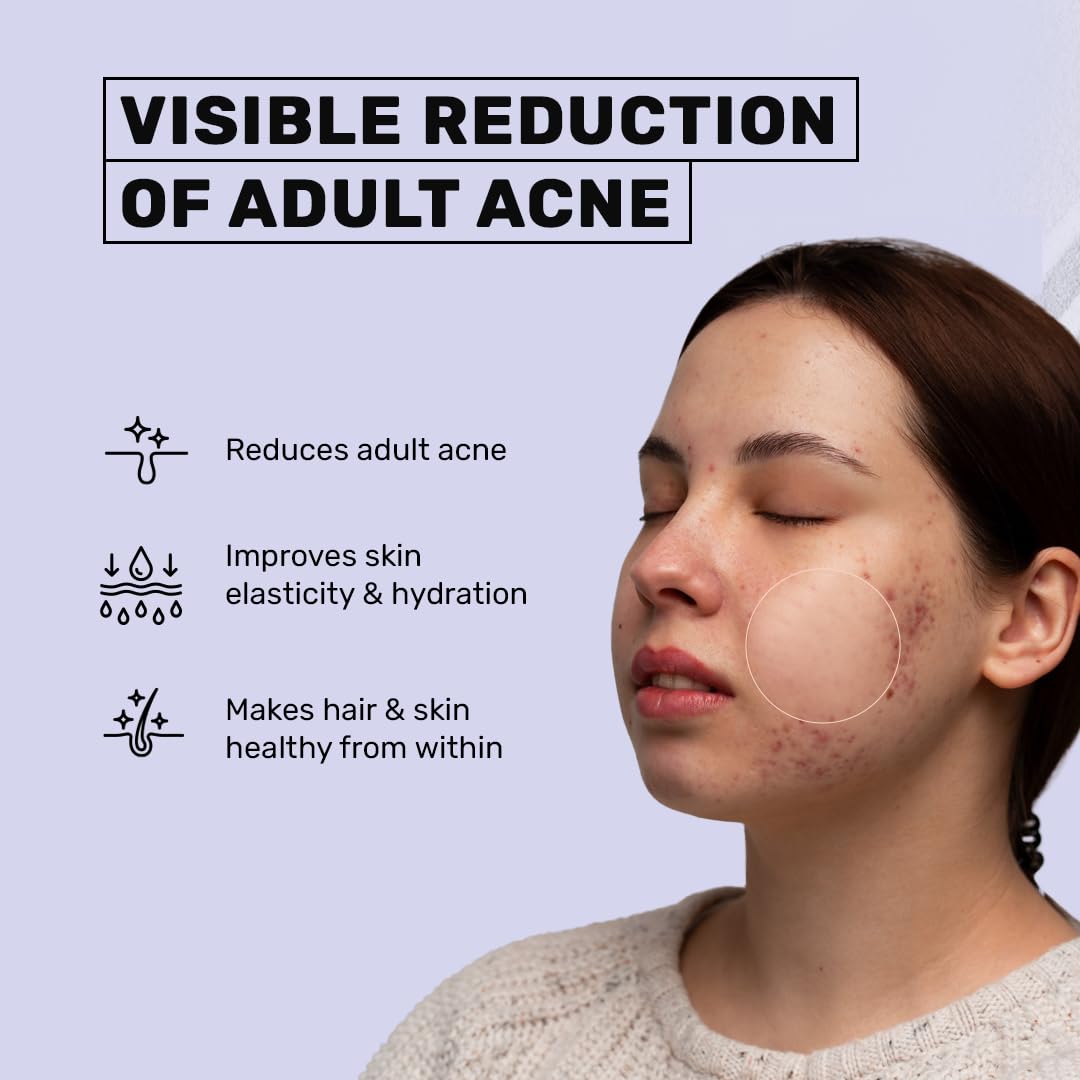 WUW_053 What's Up Wellness