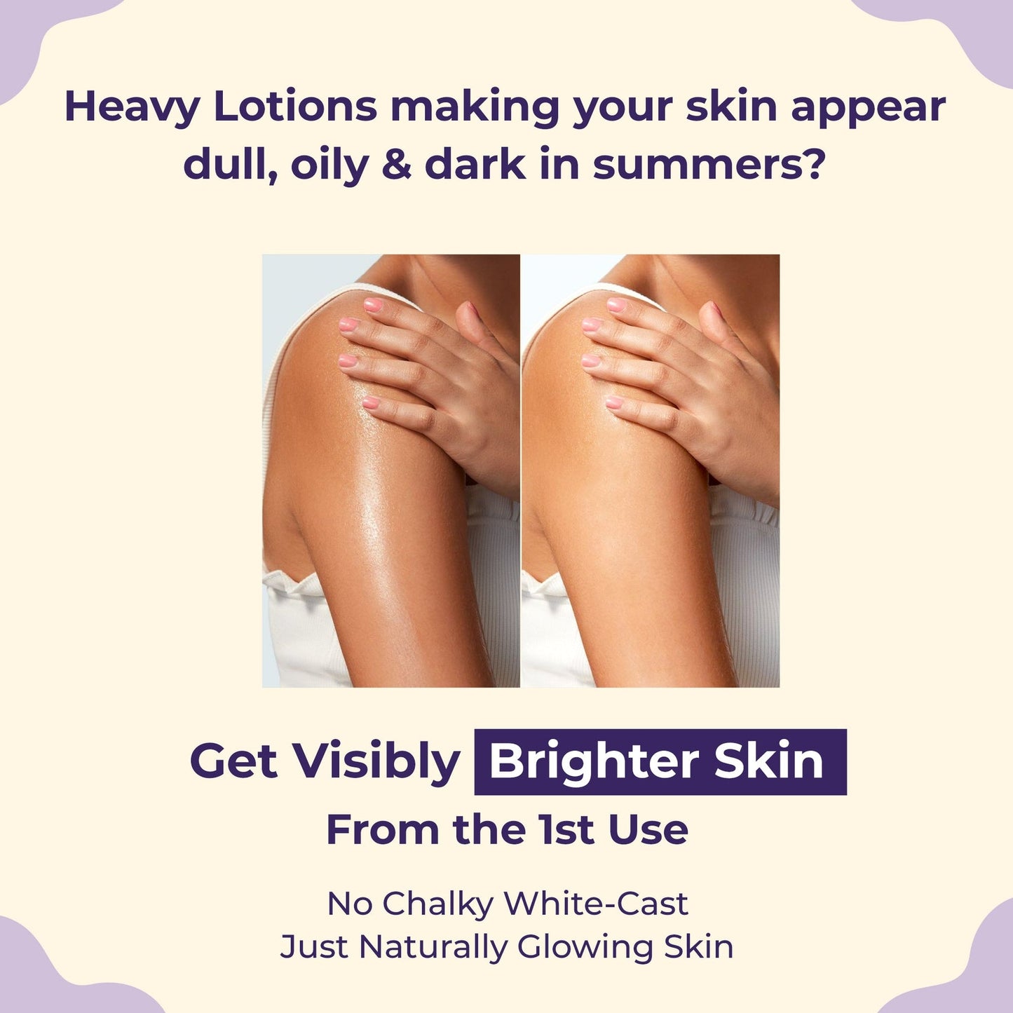 Sanfe DailyLite Body Lotion Glycopeel Technology & SPF 30 Removes & Prevents Tanning Non-Greasy Body Lotion (200)ml