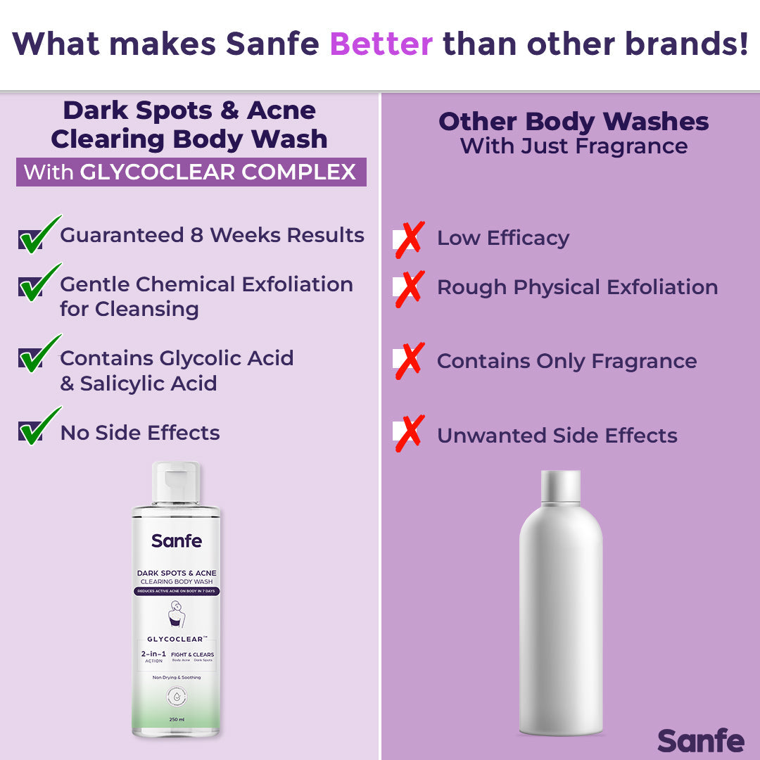 Sanfe Dark Spots & Acne Clearing Body Wash Prevents Body Acne, Bumpy Skin & Fades Dark Spots Salicylic Acid, Glycolic Acid & Tea Tree Non Drying Formula 250ml