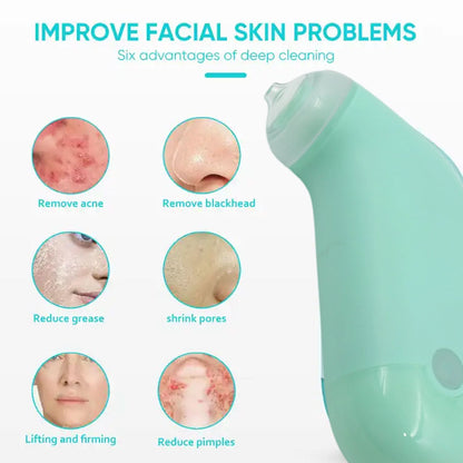 Mini Blackhead Remover Vacuum for Skin Care