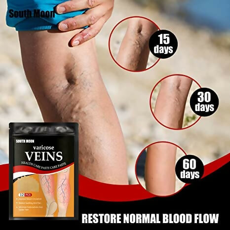 Varicose Veins Relief Patches Reduce Swelling, Improve Circulation & Soothe Leg Pain (12 Pcs)