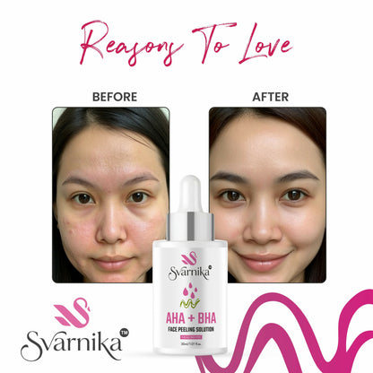 SVARNIKA AHA + BHA Face Peeling Solution Serum for Skin Texture Improvement & Dead Skin Removal (30 ml) Svarnika