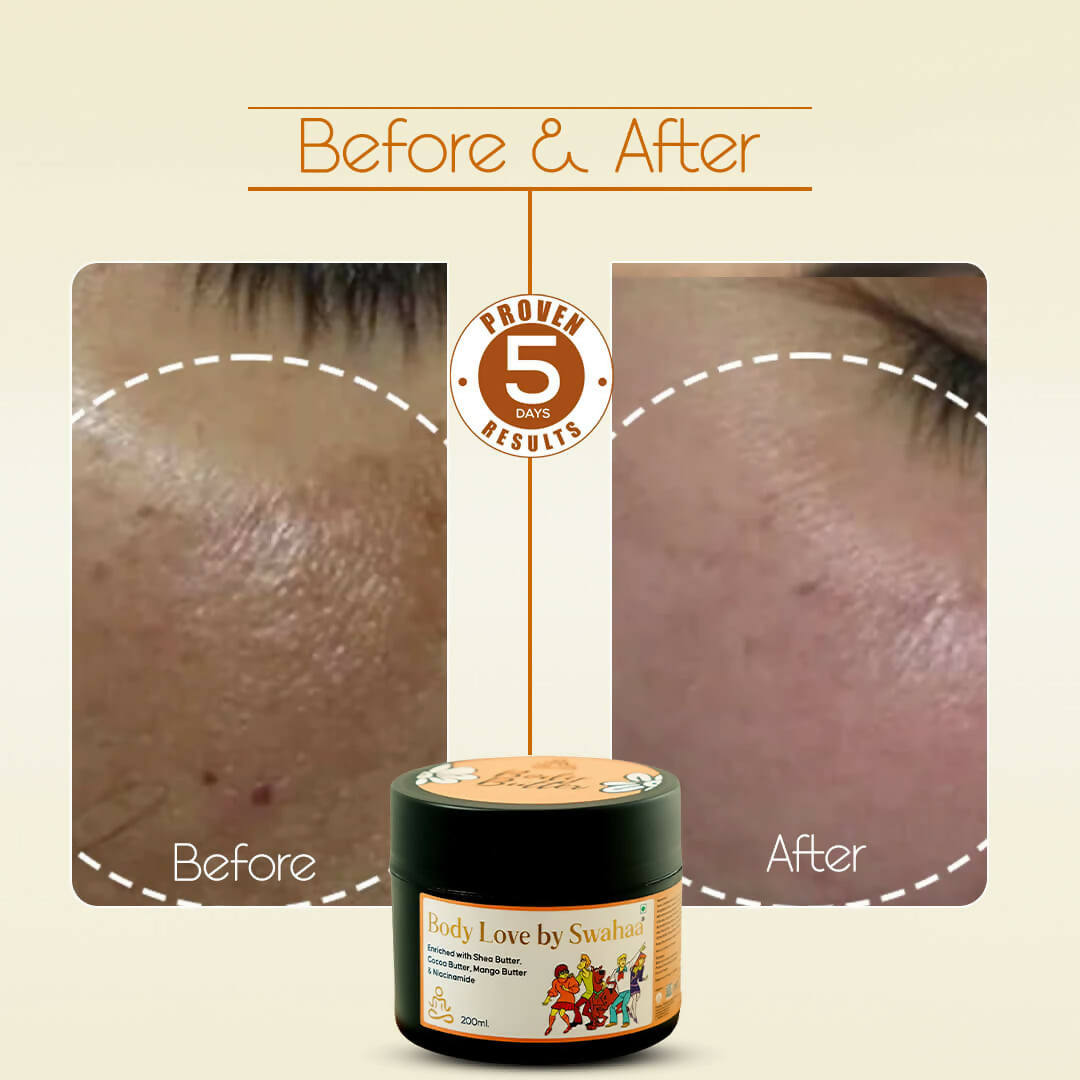 Body Butter – Moisturizing Cream (200ml)