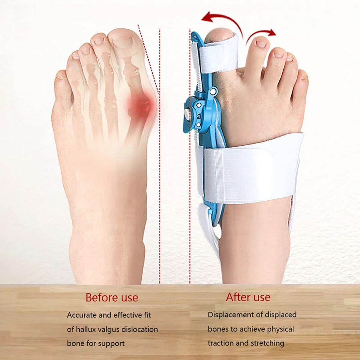 Adjustable Bunion Support Splint – Hallux Valgus Corrector for Men & Women HP DD