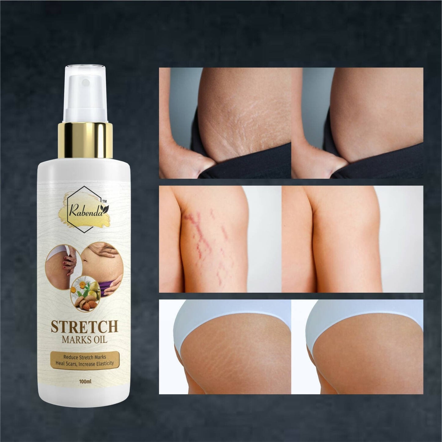 Rabenda Repair Stretch Marks Removal (100 GM) - HalfPe