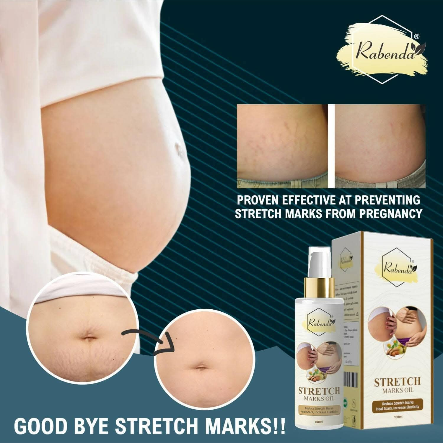 Rabenda present Repair Stretch Marks Removal pack of 2 (100 ml) - HalfPe