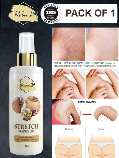 Rabenda Repair Stretch Marks Removal (100 GM) - HalfPe